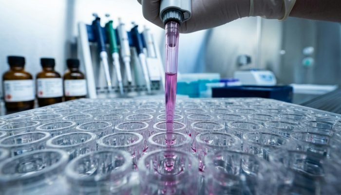 Atrofia Muscular Espinhal: a urgência do diagnóstico precoce para mudar o futuro de pacientes