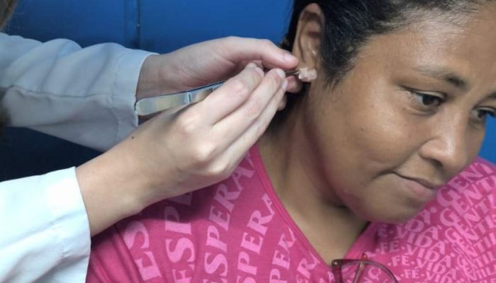auriculoterapia