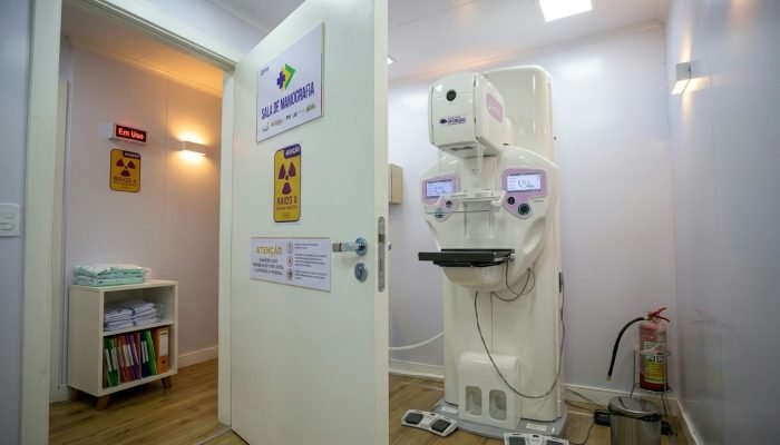 Cirurgias de mama no SUS registram aumento expressivo e superam 50% em uma década