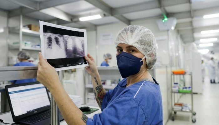 Diagnóstico avançado de câncer de pulmão compromete cura e expõe desafios no SUS