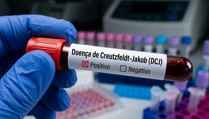 Piloto Lito Souza recebe diagnóstico de Doença de Creutzfeldt-jakob